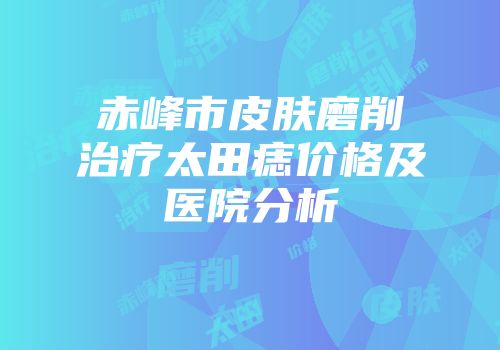 赤峰市皮肤磨削治疗太田痣价格及医院分析