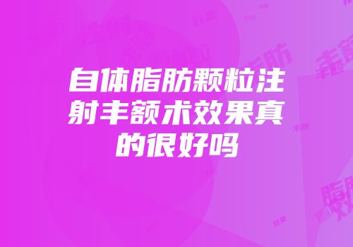 自体脂肪颗粒注射丰额术效果真的很好吗