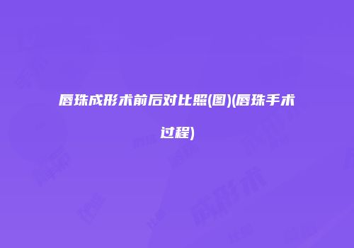 唇珠成形术前后对比照(图)(唇珠手术过程)
