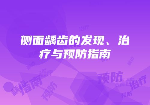 侧面龋齿的发现、治疗与预防指南