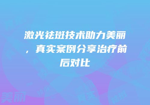 激光祛斑技术助力美丽，真实案例分享治疗前后对比
