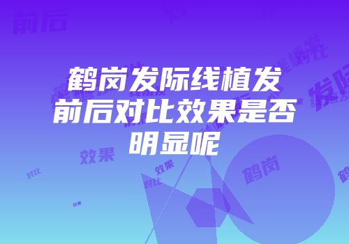 鹤岗发际线植发前后对比效果是否明显呢