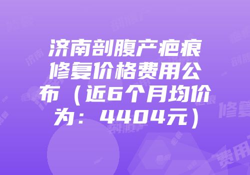 济南剖腹产疤痕修复价格费用公布（近6个月均价为：4404元）